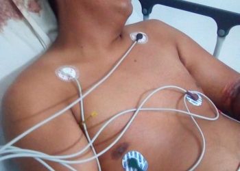 ACCIDENTE CAMBIA LA VIDA DE NEREO