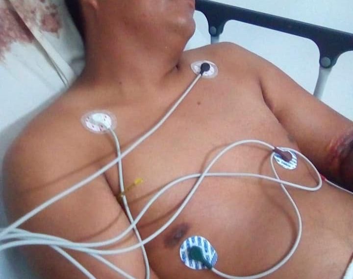 ACCIDENTE CAMBIA LA VIDA DE NEREO
