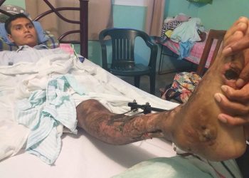 Accidente vial lo había dejado en estado vegetal, pero se aferró a seguir viviendo