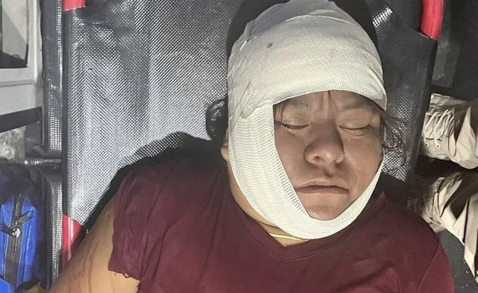 AGREDEN A TUBAZOS A MARÍA EN LA CABEZA