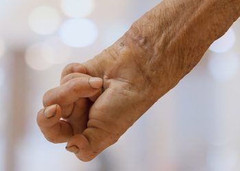 ¿Has conocido a alguien que padezca la enfermedad la lepra?